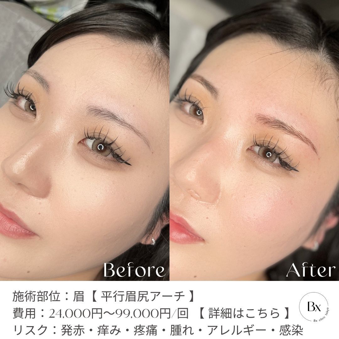 アフター