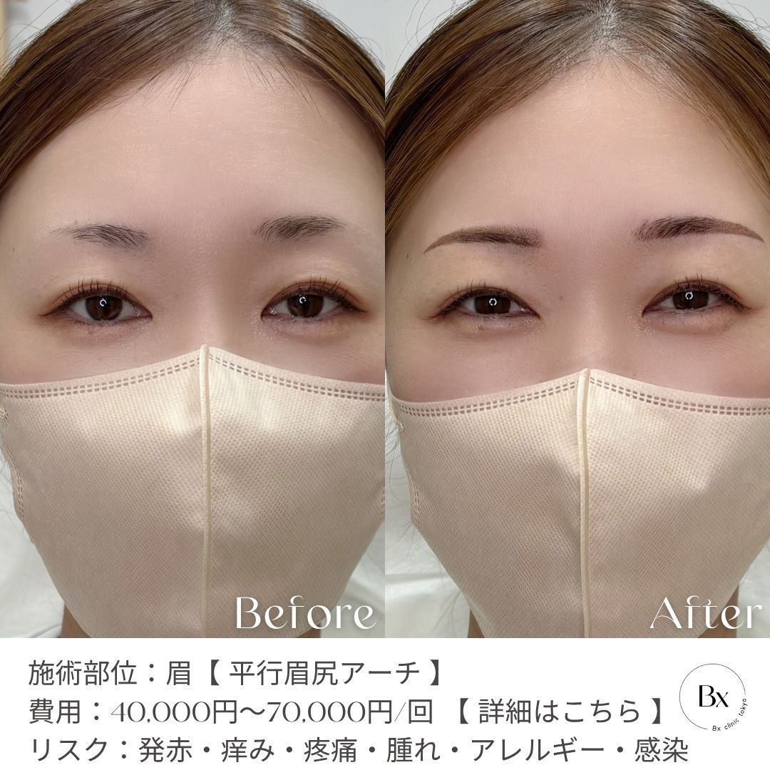 multi_image