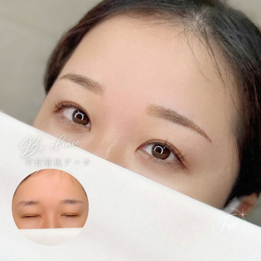 multi_image