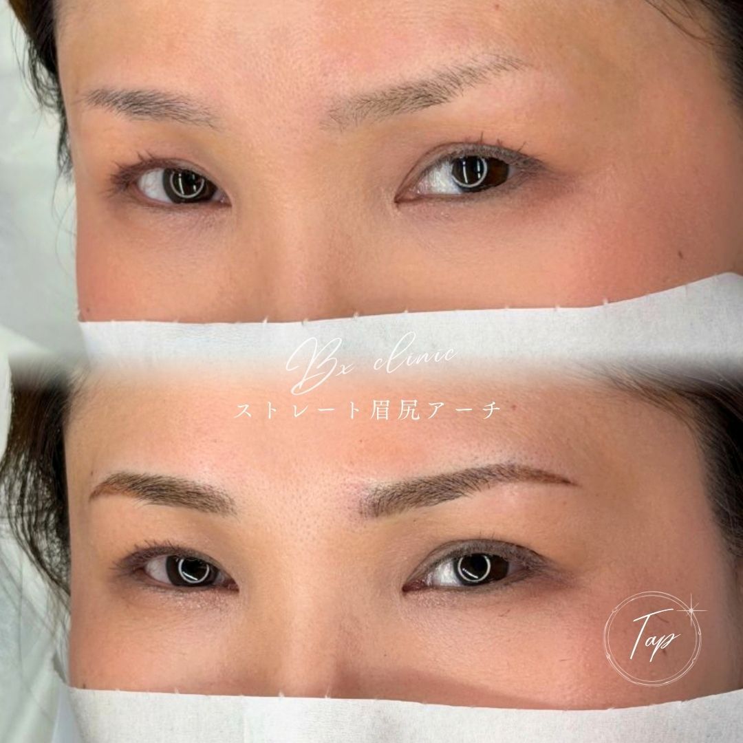 multi_image