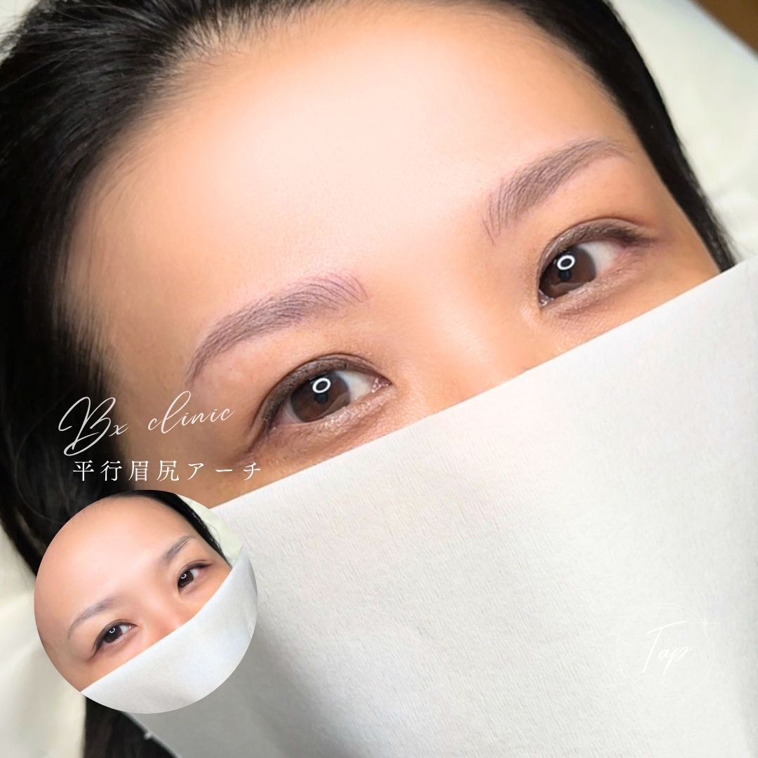 multi_image