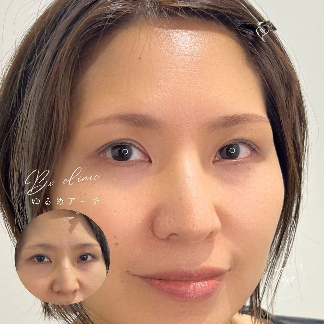 multi_image